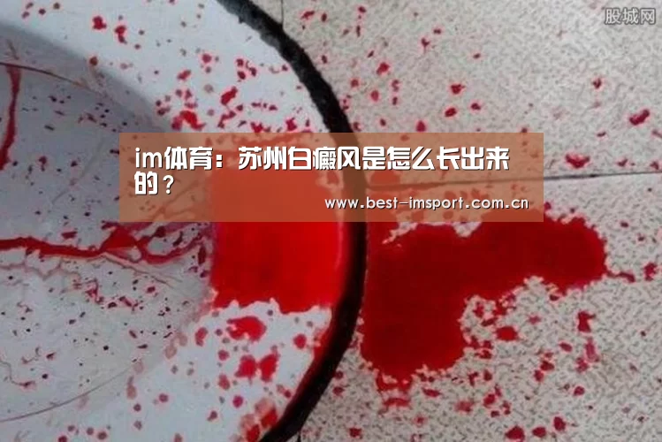 im官方